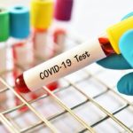 COVID-19: Oyo State Records Two New Cases - Image 1
