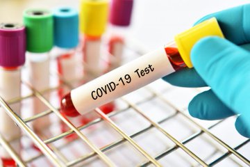 COVID-19: Oyo State Records Two New Cases - Image 1