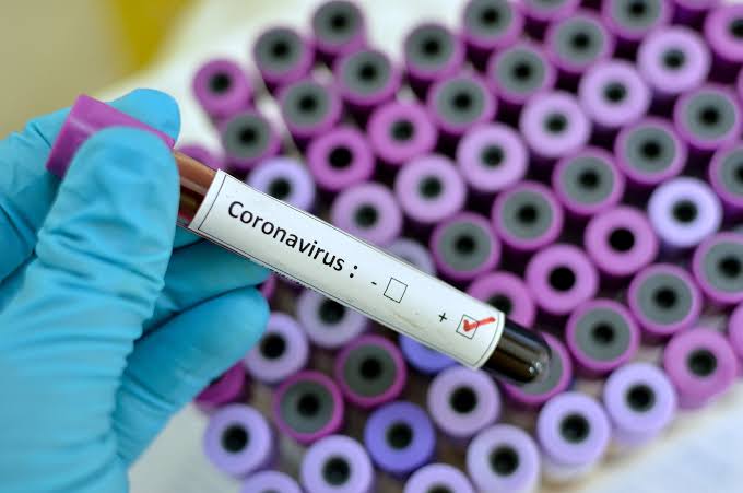 Nigerian Driver Absconds After Testing Positive For Coronavirus - Image 1