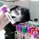 COVID-19: 30 Members Of An Organization Test Positive As Cases Rise To 107 In Oyo - Image 1