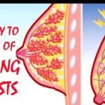 Natural and Home Remedies for Sagging Breasts - Image 1